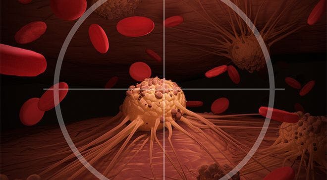 Intensifying Rituxan for Diffuse Large B-Cell Lymphoma Treatment Does Not Improve Health Outcomes