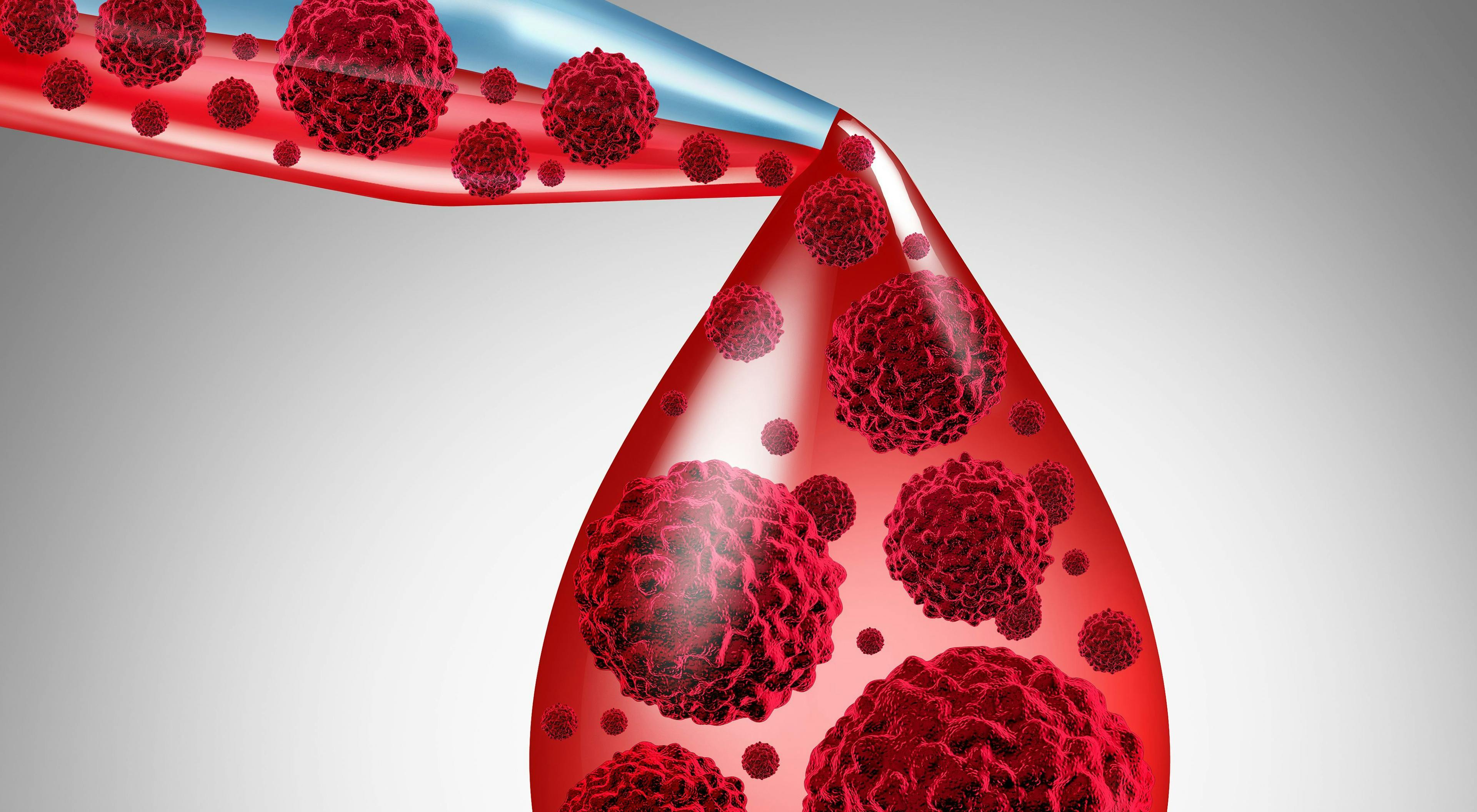 Enzastaurin May Show Benefit in Subgroup of Patients with Diffuse Large B-Cell Lymphoma