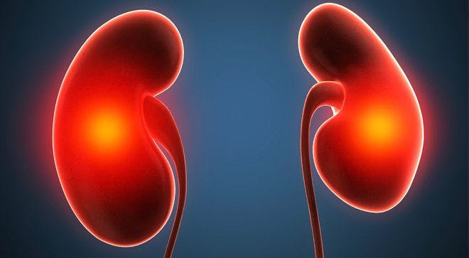 Bavencio-Inlyta Combination Shows Promise Across Subtypes of Renal Cell Carcinoma