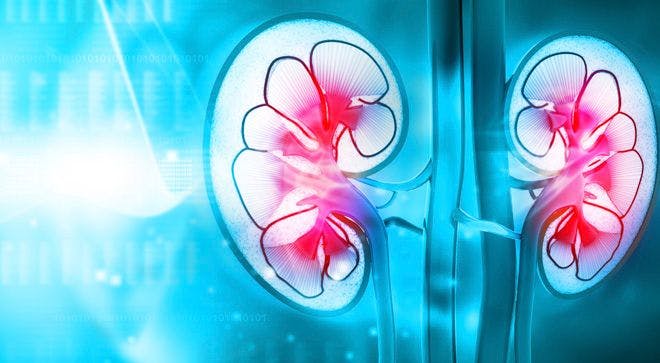 More Options in Renal Cell Carcinoma Treatment Means Greater Hope For Patients