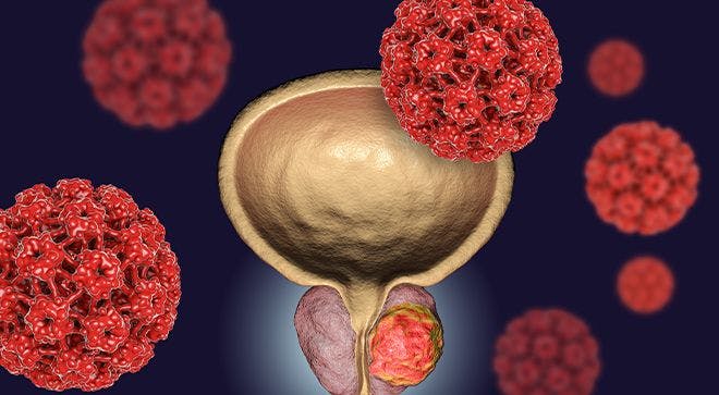 A new drug boosts survival in patients with prostate cancer