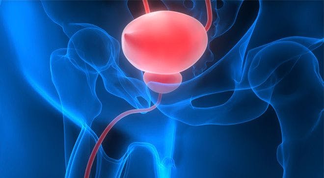 Non-Invasive Urine Tests Show Promise in Bladder Cancer Detection, Monitoring