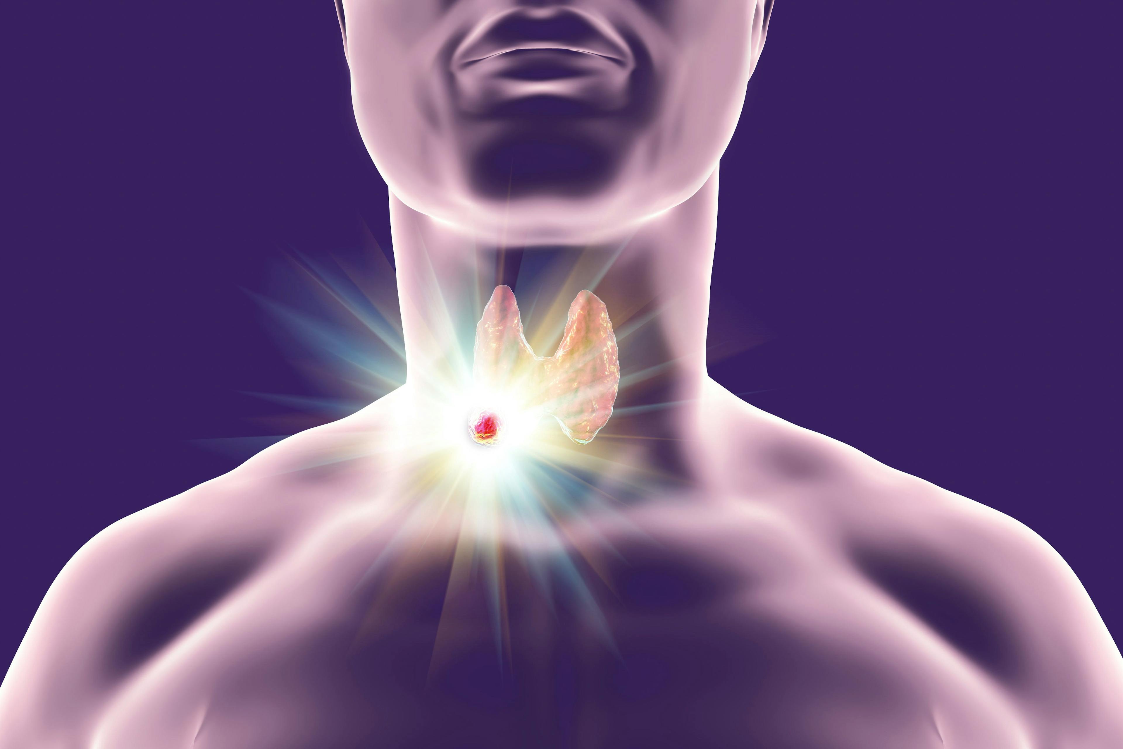 present tumor on thyroid