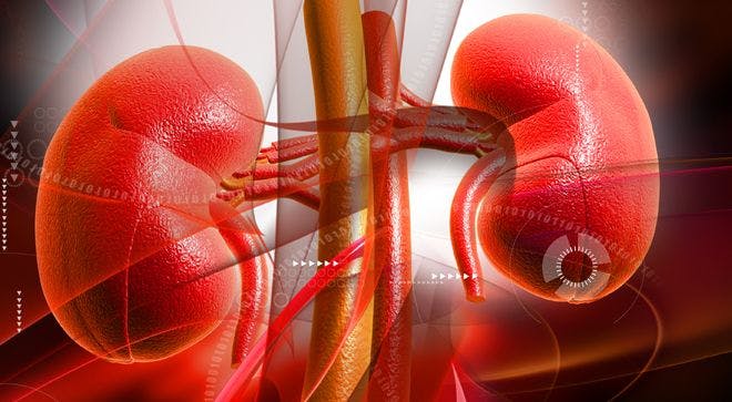 Combination of Avastin and Tarceva 'Should Be Considered Preferred Option' in Kidney Cancer Subtype